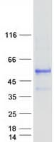 Human ERGIC3 Protein (Recombinant Myc-DDK (Flag))