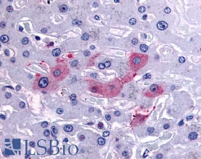 IHC-plus™ SYVN1 / HRD1 Antibody (Internal)