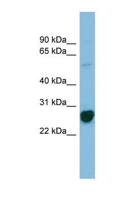 RPL10A Antibody (N-Terminus)