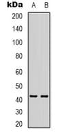 AMACR / P504S Antibody