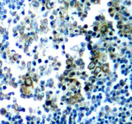 Polyclonal Rabbit anti-Human CML / BCR Antibody (phospho-Tyr177, IHC, WB)