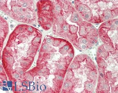 IHC-plus™ SLC4A7 Antibody (aa516-555)