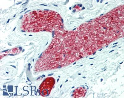 PLAU / Urokinase / uPA Antibody (aa180-433)