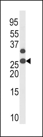 CDKN1B / p27 Kip1 Antibody (phospho-Thr187)