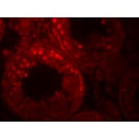 IHC-plus™ Polyclonal Rabbit anti-Human ADAM29 Antibody (IHC, IF, WB)