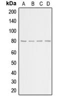 ADRBK1 / GRK2 Antibody (C-Terminus)