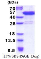 Human CFAP36 / CCDC104 Protein (Recombinant His)
