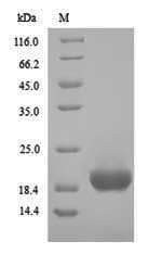 Clostridium botulinum HA-17 Protein (Recombinant 6His, N-terminus)