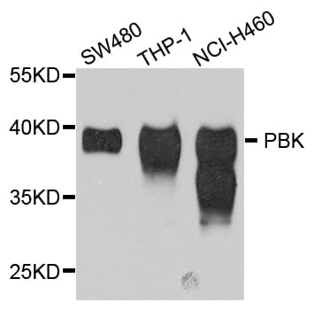 PBK / TOPK Antibody