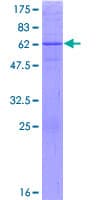 Human DHRS7 Protein (Recombinant GST)