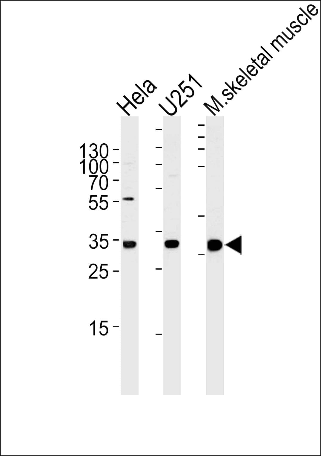 IHC-plus™ POLR2C Antibody (aa200-228)