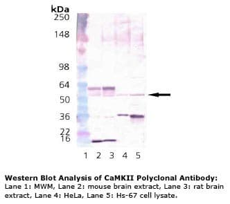 IHC-plus™ Polyclonal Rabbit anti-Rat CAMK2 / CAMKII Antibody (IHC, WB)