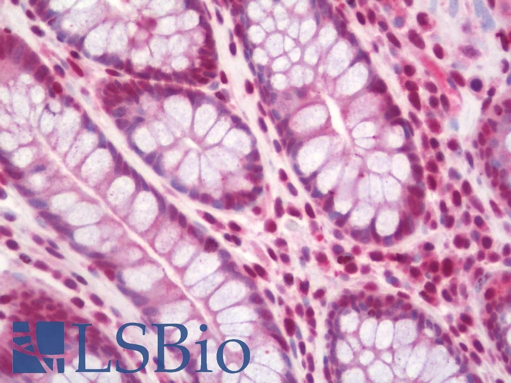 IHC-plus™ RELA / NFKB p65 Antibody (aa275-324)