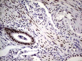 NBN / Nibrin Antibody (clone OTI6E11)