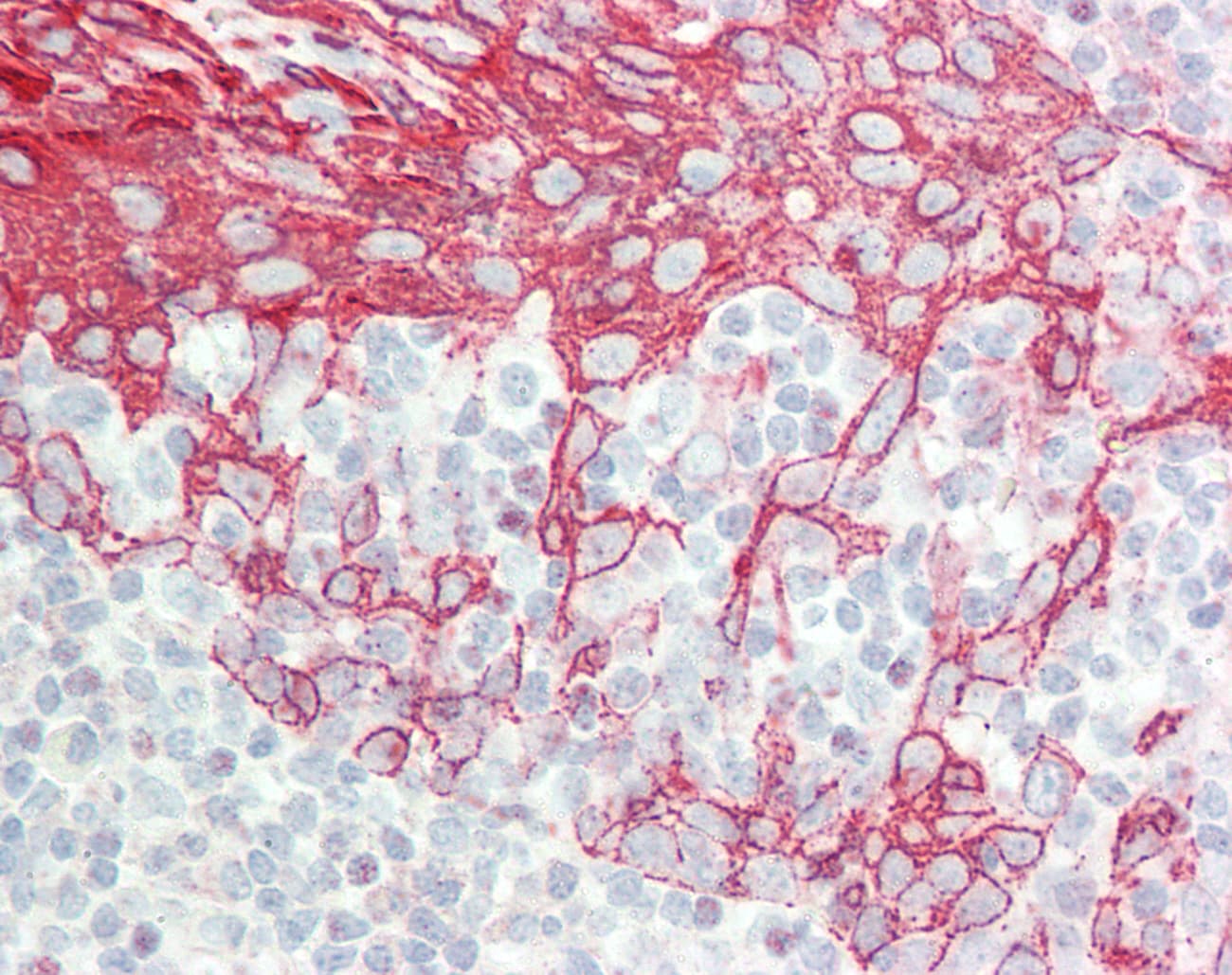 Polyclonal Rabbit anti-Human KRT6A / CK6A / Cytokeratin 6A Antibody (aa240-289, IHC, WB)