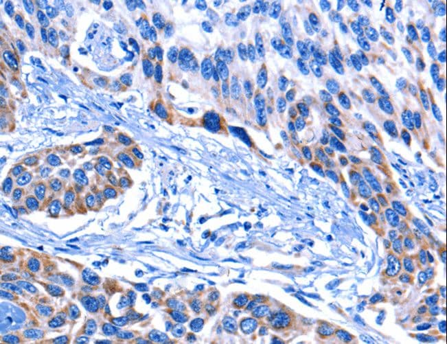 CNGA2 Antibody