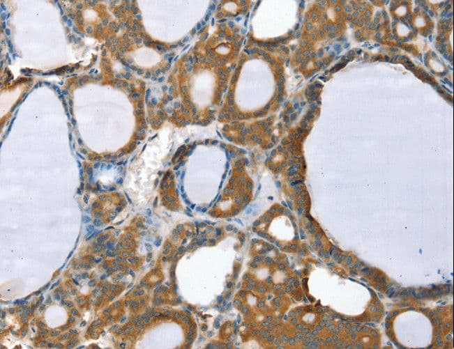Polyclonal Rabbit anti-Human PP2Ac / PPP2CA Antibody (IHC, WB)