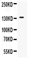 SELP / P-Selectin / CD62P Antibody (aa49-66)
