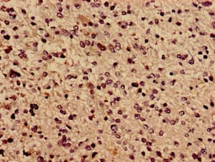 Polyclonal Rabbit anti-Human TBC1D31 / WDR67 Antibody (IHC)