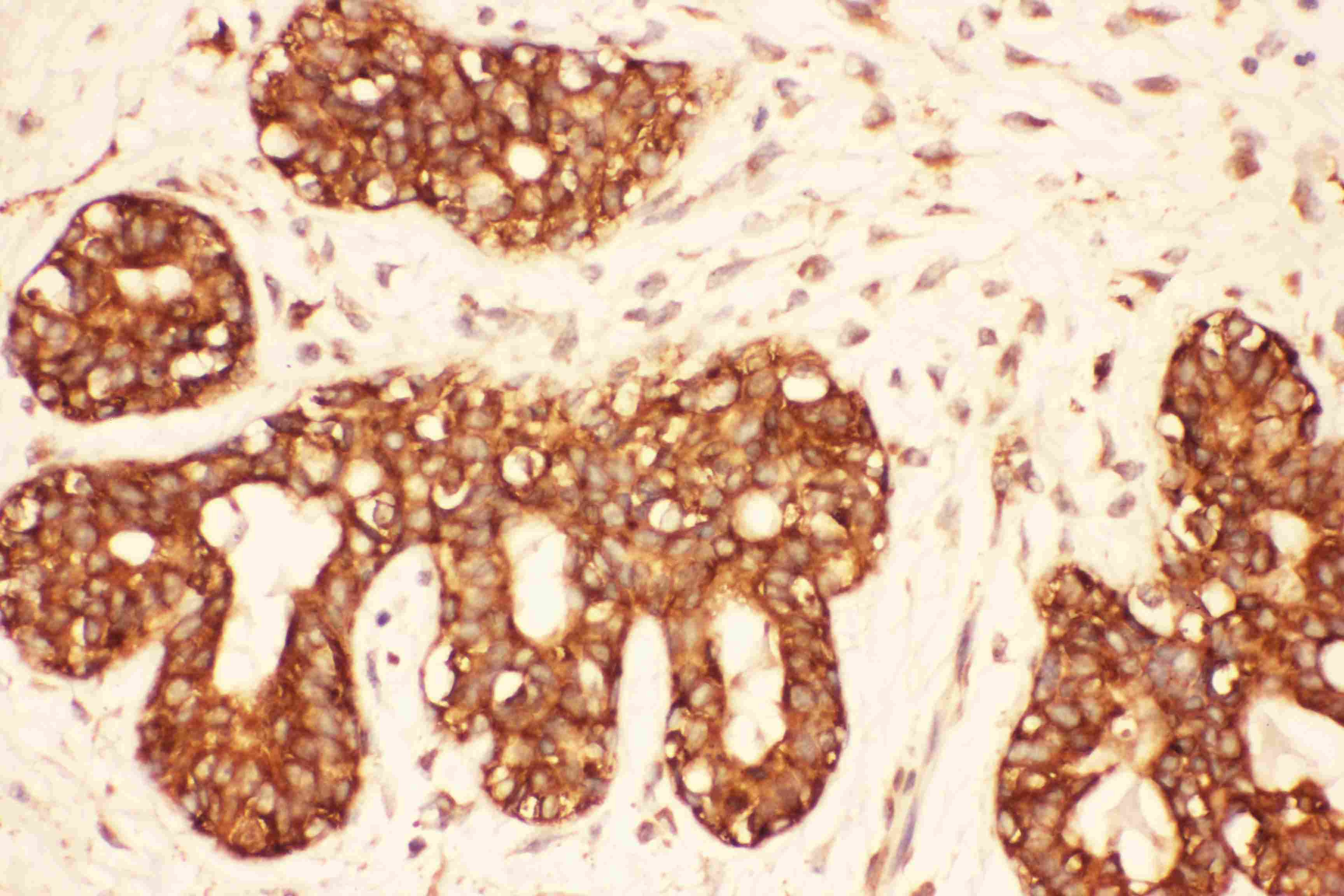 Polyclonal Rabbit anti-Human SRC Antibody (aa2-368, IHC, WB)