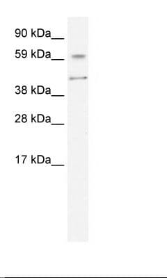 Polyclonal Rabbit anti-Human AIRE Antibody (N-Terminus, IHC, WB)