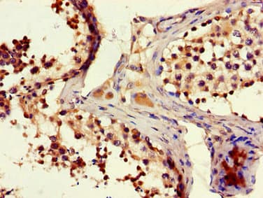 Polyclonal Rabbit anti-Human FAM102B Antibody