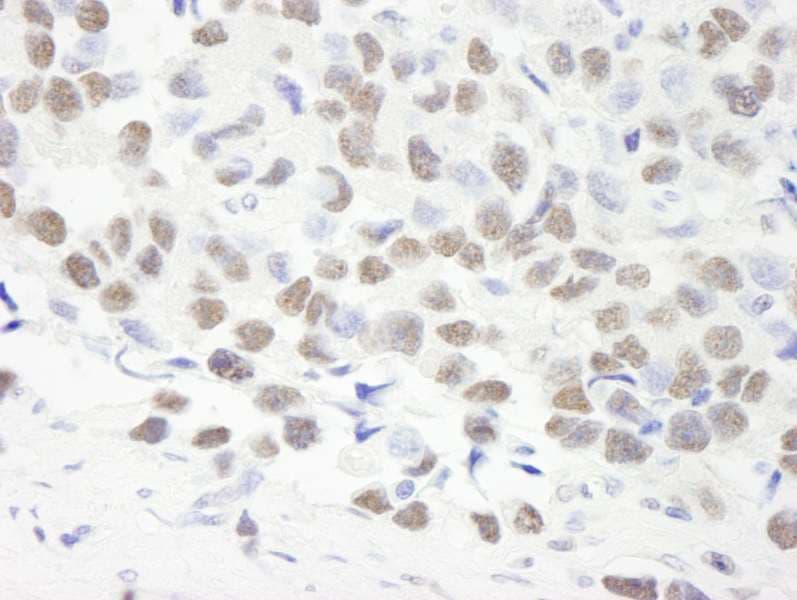 SYMPK / Symplekin Antibody (aa1224-1274)
