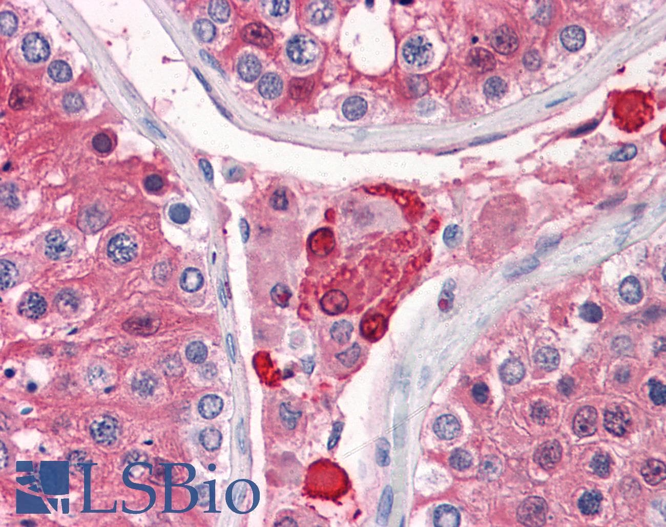 IHC-plus™ Monoclonal Mouse anti-Human GSTA3 Antibody (clone 1F11, IHC, WB)