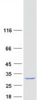 Human RAB6A / RAB6 Protein (Recombinant Myc-DDK (Flag))