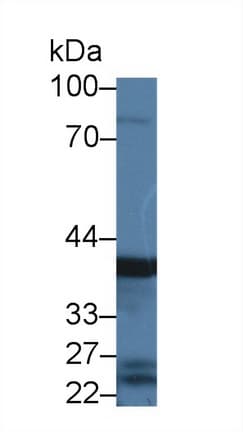 PGC / Pepsin C Antibody (aa17-392)