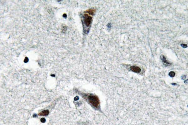 Polyclonal Rabbit anti-Human RFC3 Antibody (Leu227, IHC, WB)