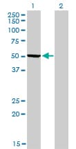 IHC-plus™ PHGDH Antibody (clone 4A3-1D6)