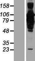 CEP85 / CCDC21 Protein (Over-Expression Lysate Myc-DDK (Flag))