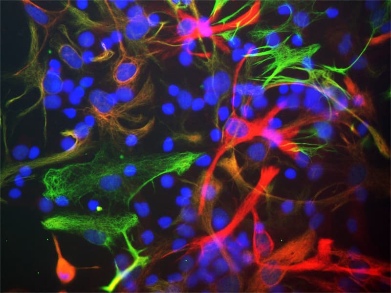 NES / Nestin Antibody (clone 4D11)