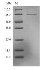 Lassa Virus SARS-CoV Nucleoprotein (Recombinant 6His, N-terminus)