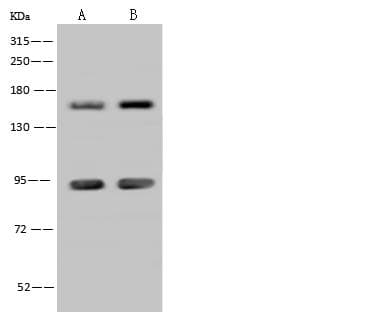 Polyclonal Rabbit anti-Human ADNP Antibody (IF, WB)