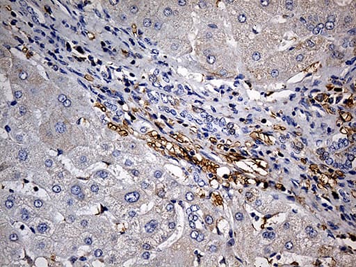 JUP/CTNNG/Junction Plakoglobin Antibody (aa500-745, clone OTI1B4)