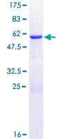 Human CHMP1B Protein (Recombinant GST)