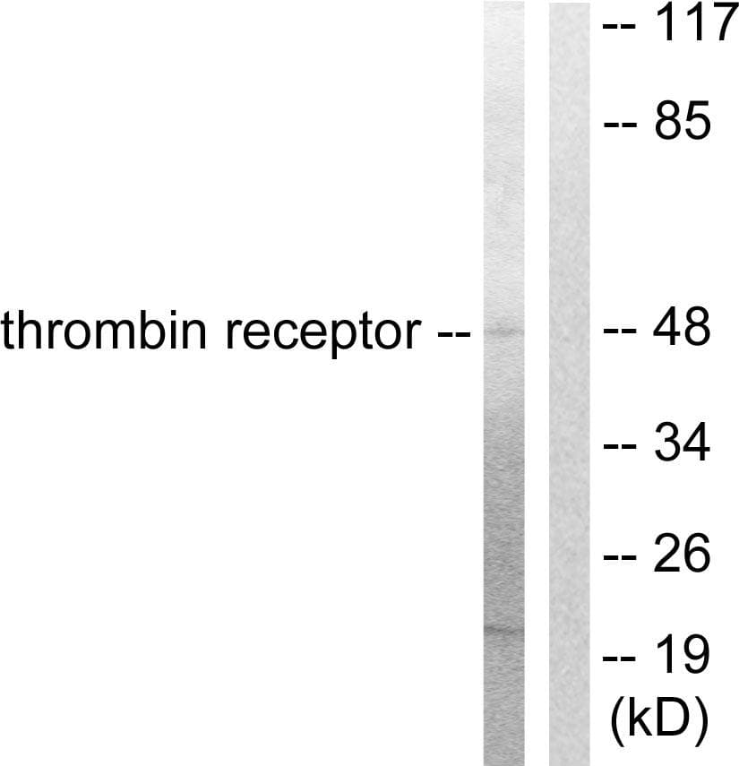 F2R / Thrombin Receptor / PAR1 Antibody