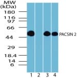 IHC-plus™ PACSIN2 Antibody (aa400-450)