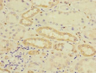 CRIP2 Antibody