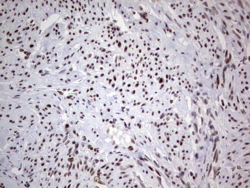 HDAC9 Antibody (aa181-460, clone OTI7G2, Carrier-free)