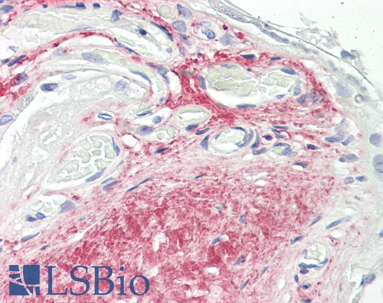 IHC-plus™ GDF15 Antibody (C-Terminus, clone 6D12.H10.E4)