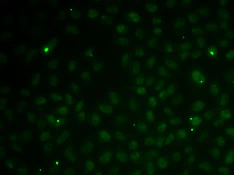 RAD51C Antibody