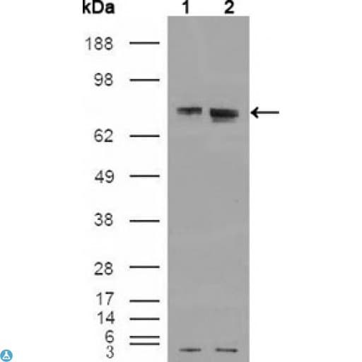ER Alpha / Estrogen Receptor Antibody