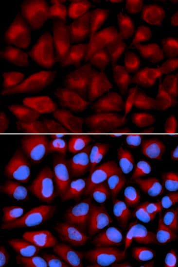 Polyclonal Rabbit anti-Human FANCC Antibody (IHC, IF, WB)