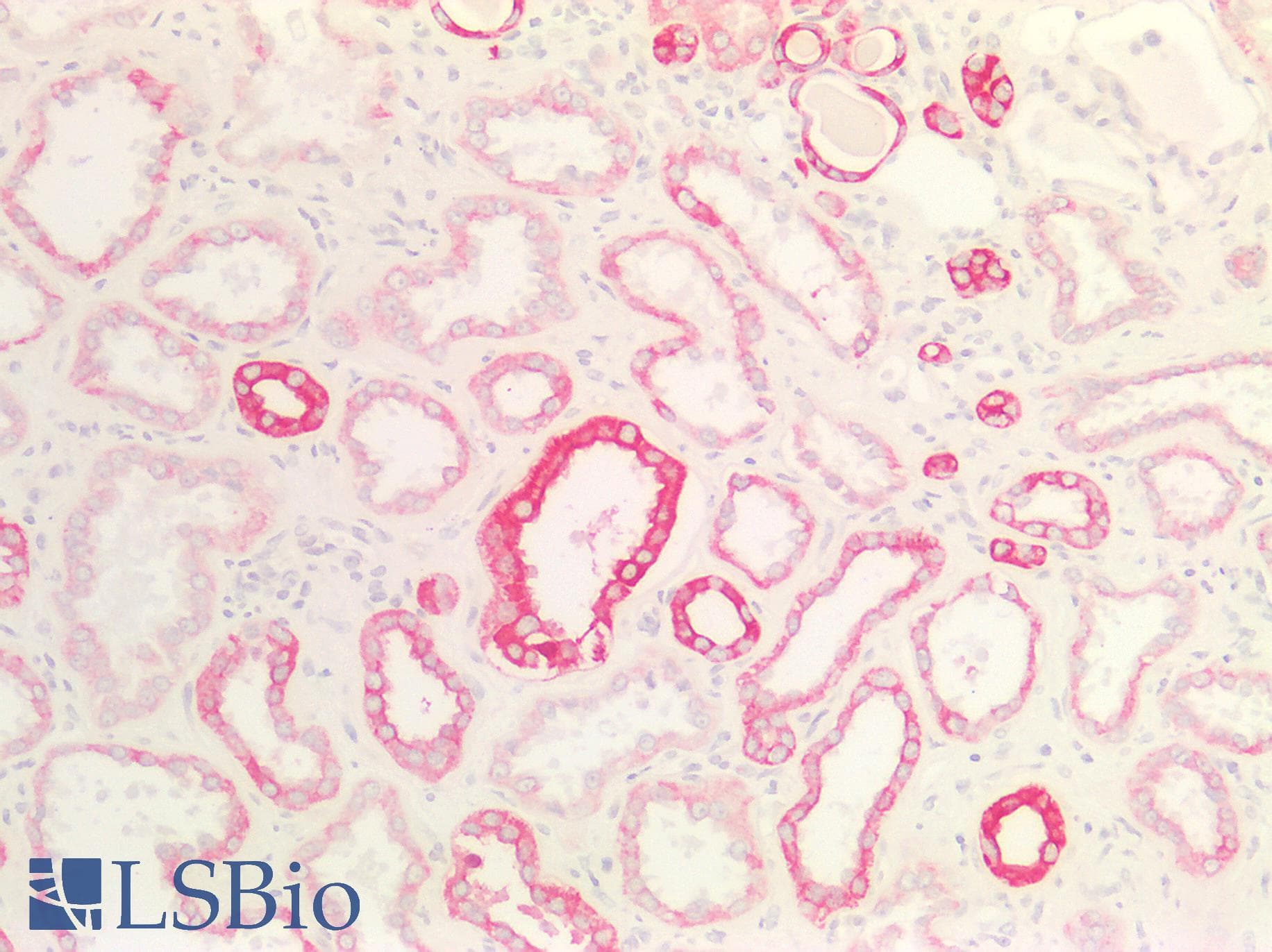 PathPlus™ Monoclonal Mouse anti-Human Cytokeratin AE1+AE3 Antibody (clone AE1 & AE3, IHC)