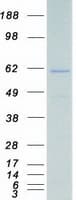 Human CAMKK1 Protein (Recombinant Myc-DDK (Flag))
