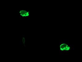 ENPEP / Aminopeptidase A Antibody (clone OTI1D6)