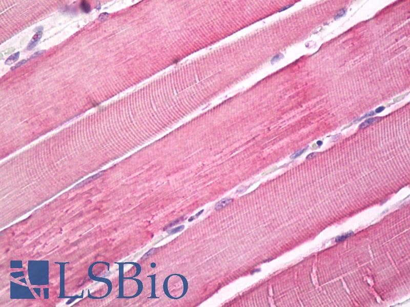 IHC-plus™ MYO10 / Myosin-X Antibody (Internal)